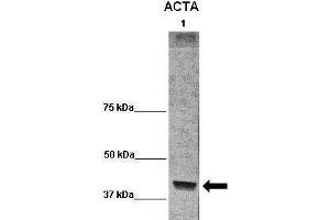 WB Suggested Anti-ACTA1 Antibody  Positive Control: Lane 1:541 µg term baboon muscle homogenate Primary Antibody Dilution: 1:0666Secondary Antibody: Anti-rabbit-HRP Secondry  Antibody Dilution: 1:0200Submitted by: Cynthia Blanco, University of Texas Health Science Center (Actin 抗体  (C-Term))