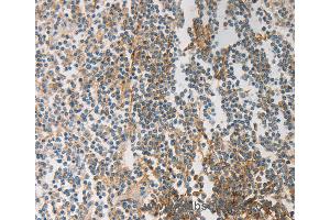 Immunohistochemistry of Human tonsil using PRMT5 Polyclonal Antibody at dilution of 1:20 (PRMT5 抗体)