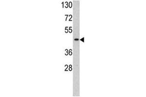 Western Blotting (WB) image for anti-TATA Box Binding Protein (TBP) (AA 301-330) antibody (ABIN3029098)
