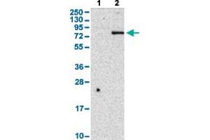 Western Blot analysis with CD248 polyclonal antibody . (CD248 抗体  (AA 375-457))