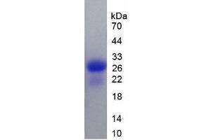 SDS-PAGE analysis of Rat Calbindin Protein. (CALB1 蛋白)