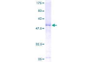 CHMP2B Protein (AA 1-213) (GST tag)