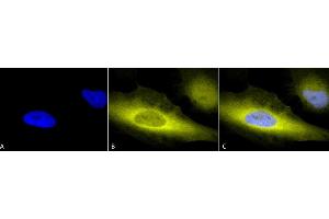 Immunocytochemistry/Immunofluorescence analysis using Rabbit Anti-Ubiquitin Polyclonal Antibody (ABIN361830 and ABIN361831).