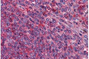 Human Spleen: Formalin-Fixed, Paraffin-Embedded (FFPE) (MIA3 抗体  (AA 1-120))