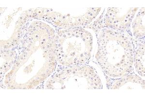 Detection of HSPA1B in Bovine Testis Tissue using Monoclonal Antibody to Heat Shock 70 kDa Protein 1B (HSPA1B) (HSPA1B 抗体  (AA 1-641))