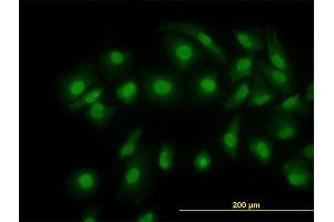 Immunofluorescence (IF) image for anti-Cofilin 1 (CFL1) (AA 1-166) antibody (ABIN514354)