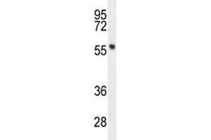 FEZF1 antibody western blot analysis in mouse stomach tissue lysate. (FEZF1 抗体  (AA 67-96))