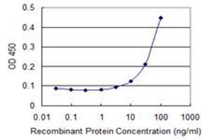 anti-Membrane Protein, Palmitoylated 5 (MAGUK P55 Subfamily Member 5) (MPP5) (AA 79-177) antibody