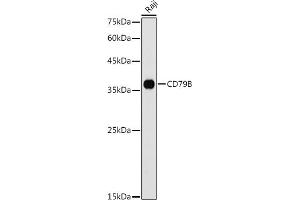 Western blot analysis of extracts of Raji cells, using CD79B antibody (ABIN3022745, ABIN3022746, ABIN3022747 and ABIN6219206) at 1:1000 dilution.