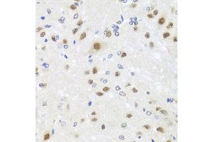 Immunohistochemistry of paraffin-embedded rat brain using CETN3 antibody (ABIN5974786) at dilution of 1/100 (40x lens). (CETN3 抗体)
