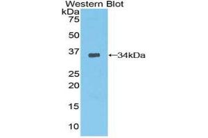 Western Blotting (WB) image for anti-3-phosphoinositide Dependent Protein Kinase-1 (PDPK1) (AA 83-338) antibody (ABIN3205317) (PDPK1 抗体  (AA 83-338))