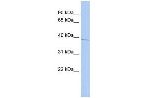 WB Suggested Anti-PNMA1 Antibody Titration:  0. (PNMA1 抗体  (Middle Region))