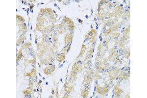 Immunohistochemistry of paraffin-embedded Human stomach using FANCA Polyclonal Antibody at dilution of 1:100 (40x lens). (FANCA 抗体)