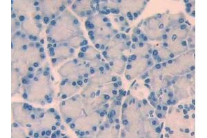 Detection of CRF in Rat Pancreas Tissue using Polyclonal Antibody to Corticotropin Releasing Factor (CRF) (CRH 抗体  (AA 39-187))