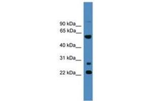 Image no. 1 for anti-Meiosis-Specific Nuclear Structural 1 (MNS1) (AA 91-140) antibody (ABIN6746497) (MNS1 抗体  (AA 91-140))