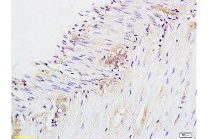 Formalin-fixed and paraffin embedded rat colitis labeled with Anti-CD28 Polyclonal Antibody, Unconjugated  at 1:200 followed by conjugation to the secondary antibody and DAB staining. (CD28 抗体  (AA 1-120))