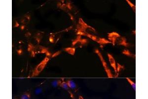 Immunofluorescence analysis of NIH/3T3 cells using DPP4 Polyclonal Antibody at dilution of 1:100. (DPP4 抗体)