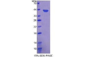 SDS-PAGE (SDS) image for CD9 (CD9) (AA 112-195) protein (His tag,GST tag) (ABIN4988602) (CD9 Protein (CD9) (AA 112-195) (His tag,GST tag))