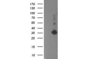 Western Blotting (WB) image for anti-Sirtuin 5 (SIRT5) antibody (ABIN1500935) (SIRT5 抗体)