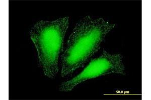 Immunofluorescence of monoclonal antibody to ATOX1 on HeLa cell. (ATOX1 抗体  (AA 1-68))