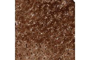 Immunohistochemical staining of human liver with ZNF862 polyclonal antibody  shows strong cytoplasmic positivity in hepatocytes. (ZNF862 抗体)