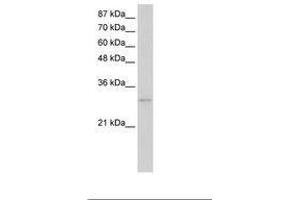 Image no. 3 for anti-Exosome Component 6 (EXOSC6) (N-Term) antibody (ABIN202141) (EXOSC6 抗体  (N-Term))