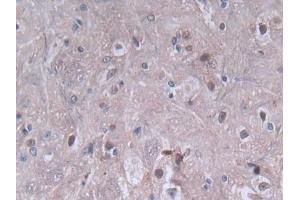 DAB staining on IHC-P; Samples: Rat Spinal cord Tissue (PF4 抗体  (AA 30-105))