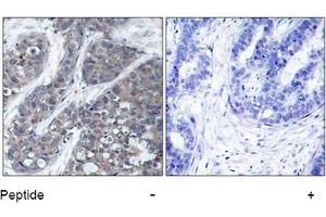 Image no. 1 for anti-PTK2B Protein tyrosine Kinase 2 beta (PTK2B) (Tyr402) antibody (ABIN197440) (PTK2B 抗体  (Tyr402))