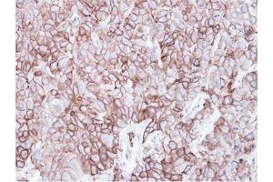 AP31081PU-N CAV2 antibody staining of Paraffin-Embedded FaDu xenograft at 1/500 dilution. (Caveolin 2 抗体  (AA 1-45))