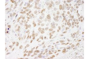 Immunohistochemistry (IHC) image for anti-Histone H3 (H3) (C-Term) antibody (ABIN7448974) (Histone 3 抗体  (C-Term))