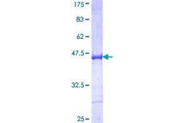 Golgi Integral Membrane Protein 4 (GOLIM4) (AA 473-568) protein (GST tag)