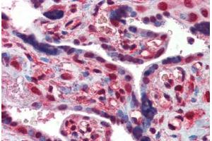 Immunohistochemistry (Formalin-fixed Paraffin-embedded Sections) (IHC (fp)) image for anti-Eukaryotic Translation Initiation Factor 4E Binding Protein 1 (EIF4EBP1) (AA 101-118) antibody (ABIN462434)