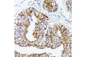 Immunohistochemistry (IHC) image for anti-TNF Receptor-Associated Protein 1 (TRAP1) (AA 445-704) antibody (ABIN1683134)