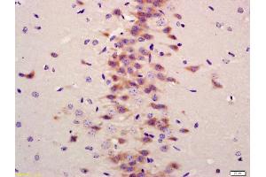 Formalin-fixed and paraffin embedded mouse brain labeled with Anti-LC3A/B Polyclonal Antibody, Unconjugated (ABIN1386290) at 1:200 followed by conjugation to the secondary antibody and DAB staining (LC3A / LC3B (AA 31-121) 抗体)