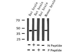 Western blot analysis of Phospho-MEK1 (Thr291) expression in various lysates (MEK1 抗体  (pThr292))