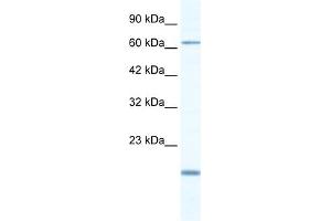 WB Suggested Anti-TBX5 Antibody Titration:  0. (T-Box 5 抗体  (N-Term))