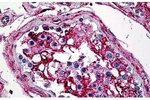 Human Testis: Formalin-Fixed, Paraffin-Embedded (FFPE) (Annexin V 抗体  (AA 1-321))