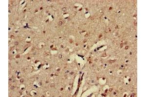 Immunohistochemistry of paraffin-embedded human brain tissue using ABIN7151843 at dilution of 1:100 (EPH Receptor A5 抗体  (AA 246-514))