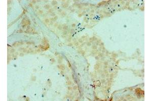 Immunohistochemistry of paraffin-embedded human testis tissue using ABIN7150791 at dilution of 1:100 (DYRK2 抗体  (AA 502-601))