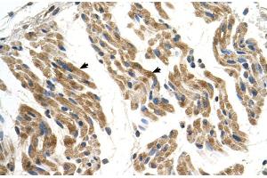 Human Muscle (SLC35F2 抗体  (N-Term))