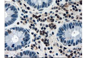 Immunohistochemical staining of paraffin-embedded colon using anti-APOM (ABIN2452530) mouse monoclonal antibody. (Apolipoprotein M 抗体  (AA 23-188))