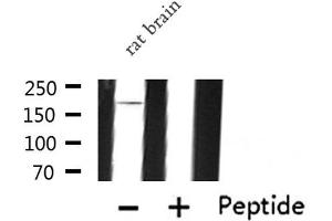 Western blot analysis of IQGAP1 expression in Rat brain lysate (IQGAP1 抗体  (N-Term))