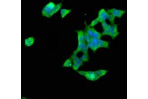 Immunofluorescence staining of 293 cells with ABIN7170440 at 1:66, counter-stained with DAPI. (SPTBN1 抗体  (AA 2096-2256))
