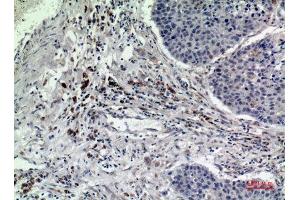 Immunohistochemistry (IHC) image for anti-RAB5A, Member RAS Oncogene Family (RAB5A) (Internal Region) antibody (ABIN3187950)