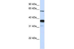 WB Suggested Anti-SMPD3 Antibody Titration:  0. (SMPD3 抗体  (Middle Region))