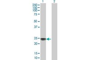 Western Blot analysis of NDUFS8 expression in transfected 293T cell line by NDUFS8 MaxPab polyclonal antibody. (NDUFS8 抗体  (AA 1-210))