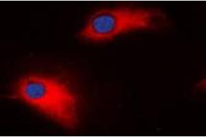 Immunofluorescent analysis of MMP8 staining in SW620 cells. (MMP8 抗体  (C-Term))