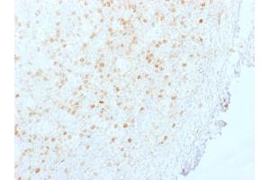 Formalin-fixed, paraffin-embedded human Tonsil stained with Aurora B Mouse Monoclonal Antibody (AURKB/1845). (Aurora Kinase B 抗体  (AA 89-251))