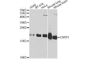 Western blot analysis of extracts of various cell lines, using CSRP1 Antibody. (CSRP1 抗体  (AA 1-193))