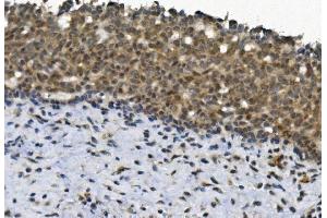 IHC analysis of EYA4 using anti-EYA4 antibody (ABIN7601063). (EYA4 抗体  (AA 28-205))